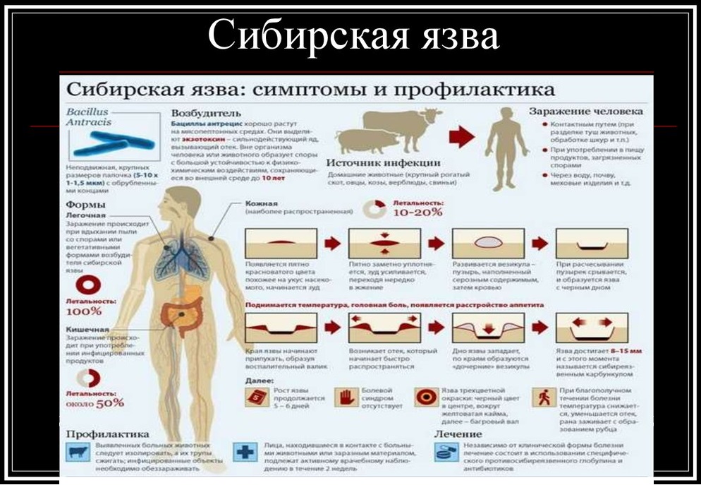 Сибирская язва: симптомы и профилактика.